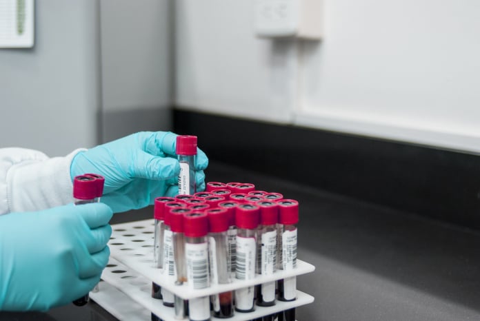 common tests